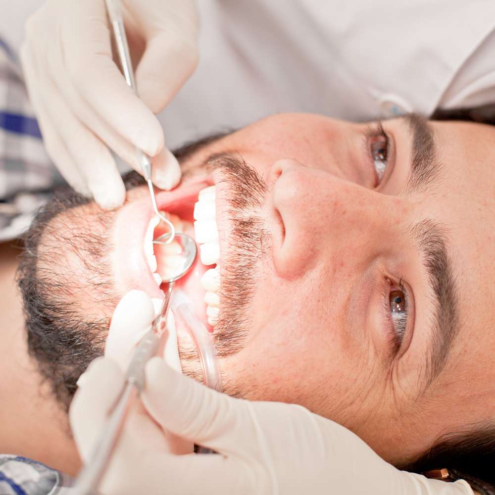 What a Dental Cleaning Should Actually Cost